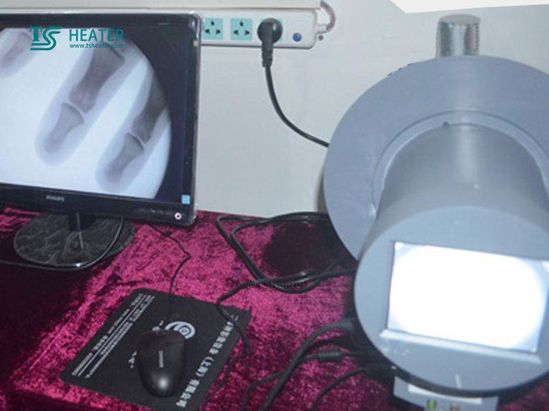 Portable X-ray fluoroscope